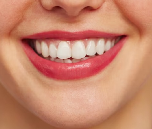 Full Smile